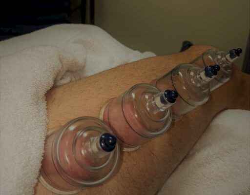 Myosynergy Balwyn massage & cupping